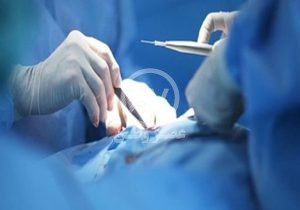 خارج کردن یک قاشق از معده جوان تویسرکانی