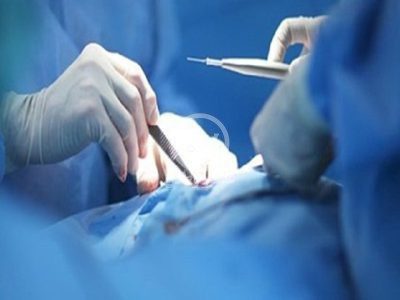 خارج کردن یک قاشق از معده جوان تویسرکانی