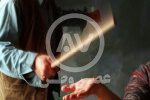 تنبیه بدنی دانش‌آموز ۱۳ ساله را در بیمارستان بستری کرد