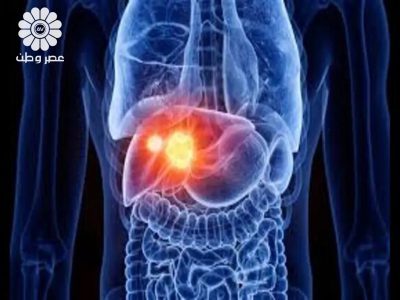 راه‌های جلوگیری از سرطان با ورزش و تغذیه