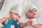 دوقلوهای بهم چسبیده پاکستانی از هم جدا شدند/ عکس