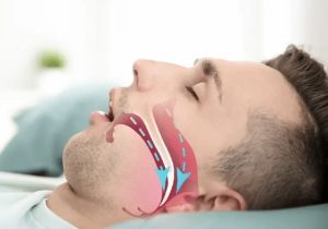 آپنه خواب ممکن است به مغز آسیب بزند و پیری را تسریع کند