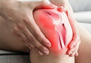 روش جدید کاهش درد آرتروز زانو بدون جراح