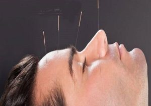 طب سوزنی کدام بیماری‌ها را درمان می‌کند