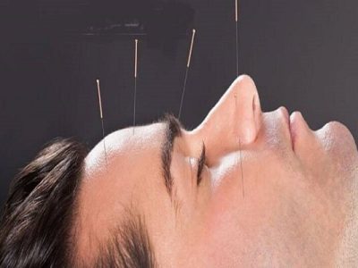 طب سوزنی کدام بیماری‌ها را درمان می‌کند